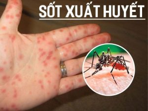 muỗi gây bệnh sốt xuất huyết trong gia đình